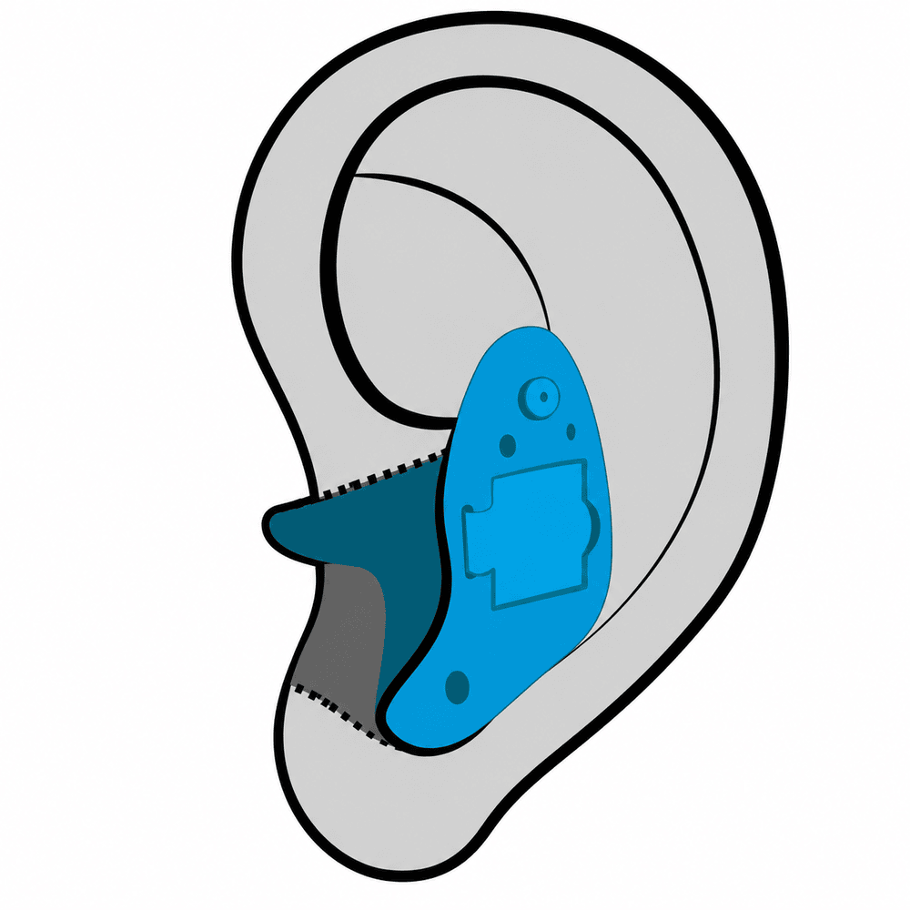 In-the-ear (ITE) custom hearing aid style fitted at AUDIO-LOGIC, PC in Columbus, NE