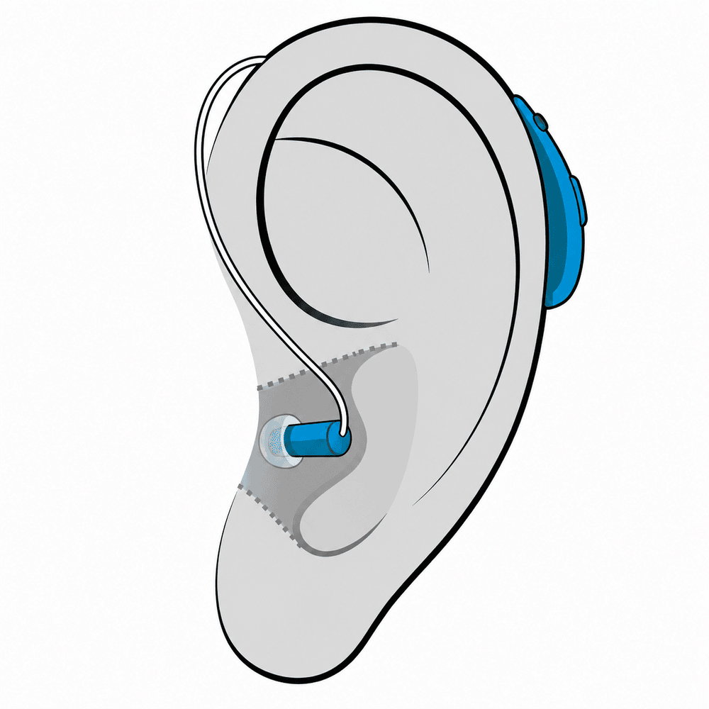 Receiver-in-canal (RIC) hearing aid style fitted at AUDIO-LOGIC, PC in Columbus, NE